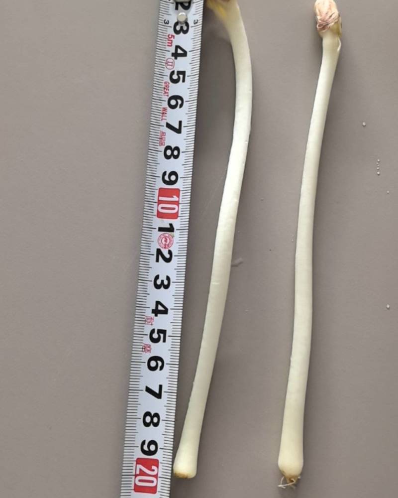 10公分之18公分