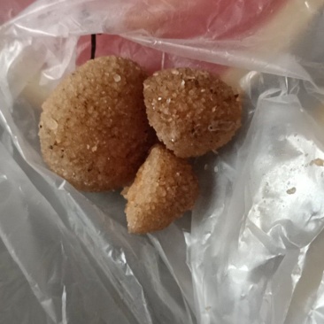 猪结石