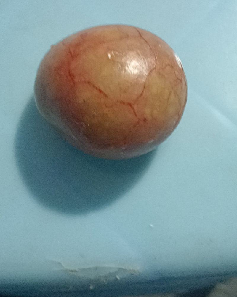 鸭宝
