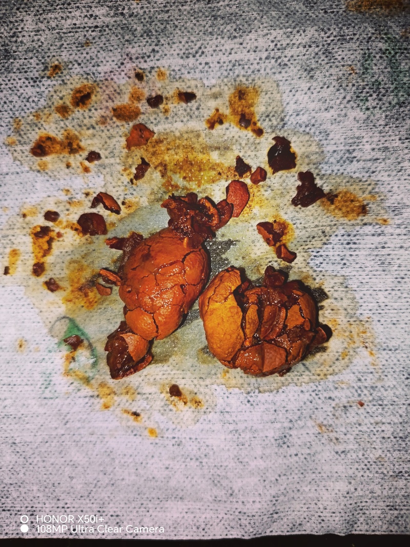 天然牛黄
