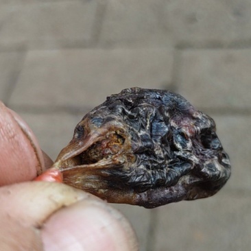 猪胆结石