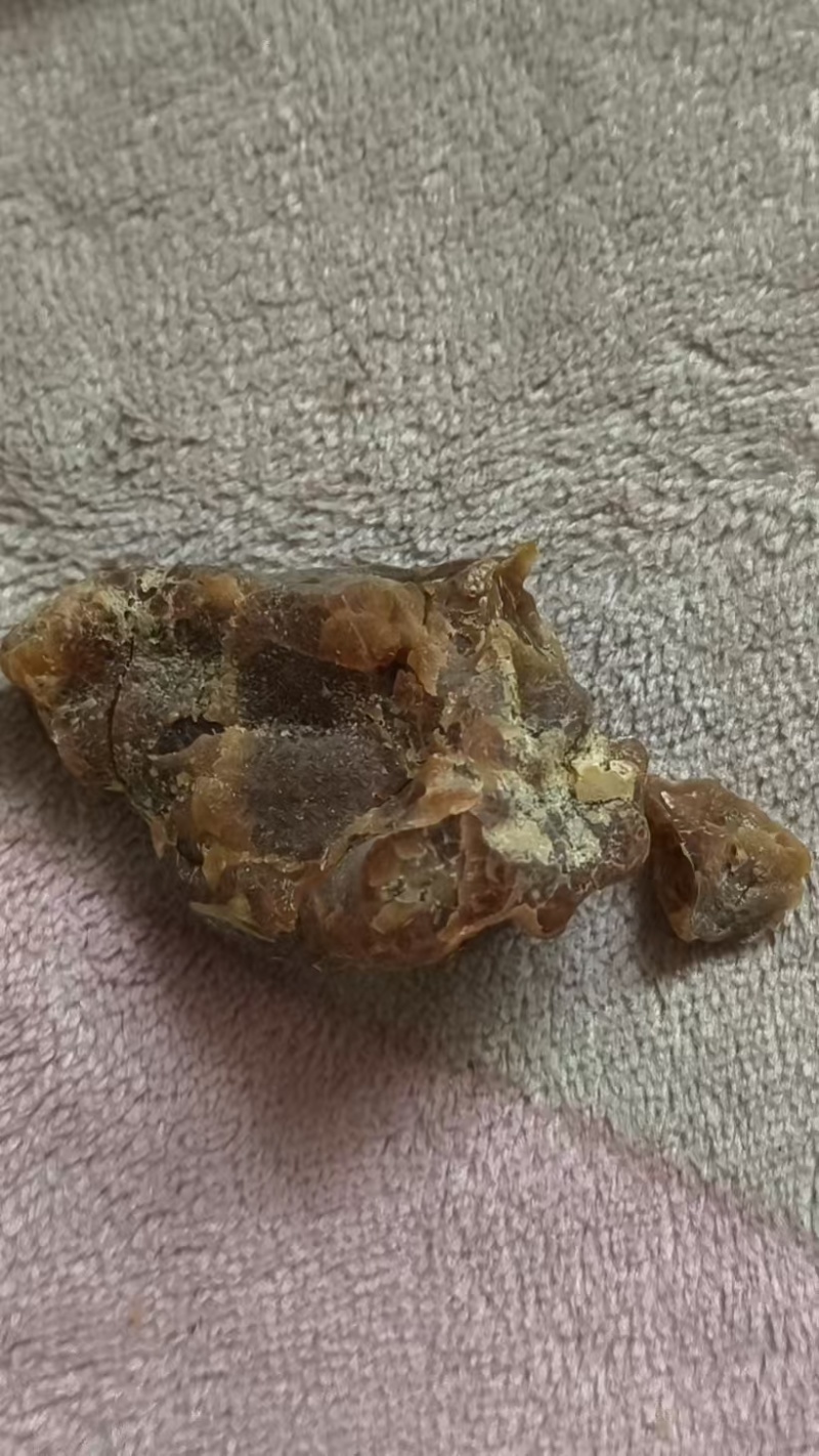 鸡宝