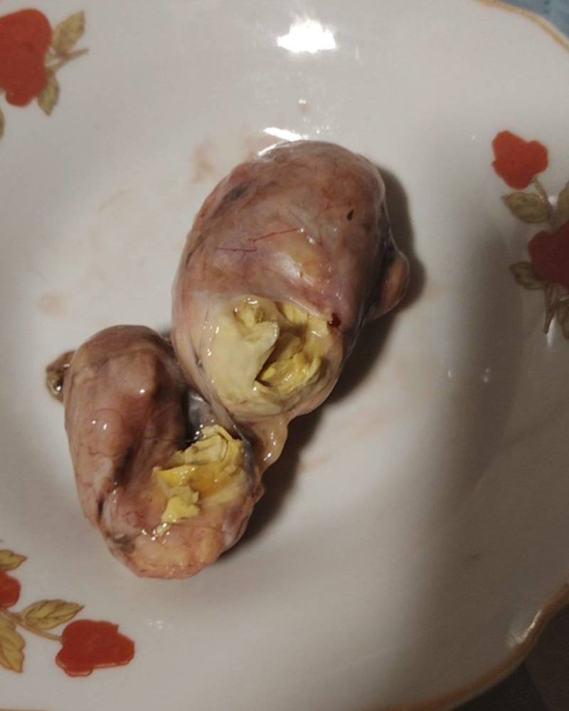 鸡宝