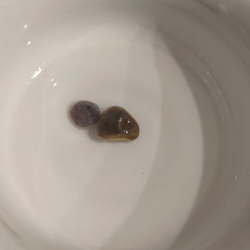 8年的老鸭子，肚子里弄了2只蛋蛋出来，大家看值多少米？