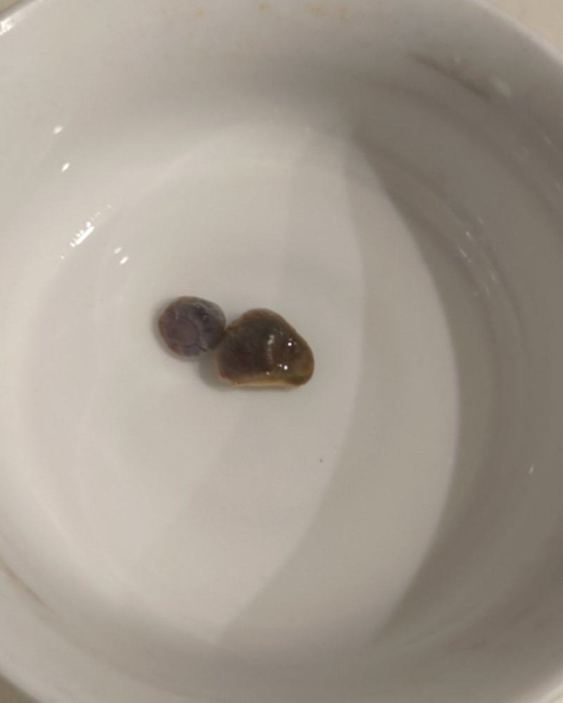 8年的老鸭子，肚子里弄了2只蛋蛋出来，大家看值多少米？