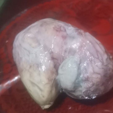鸡宝