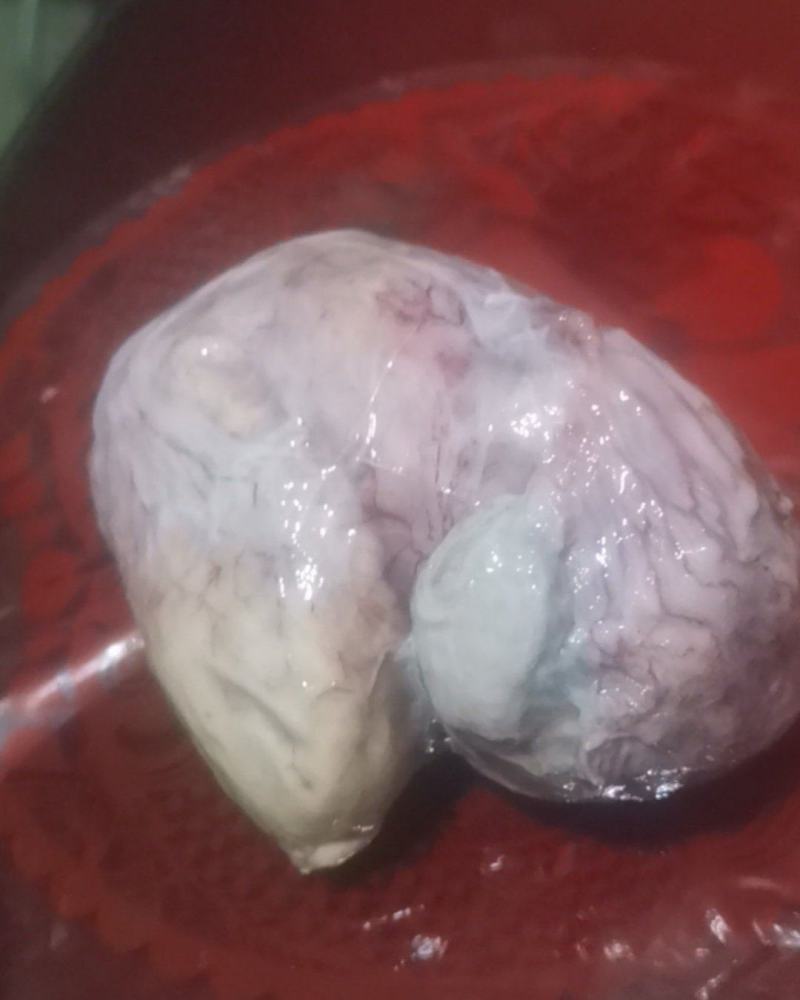 鸡宝