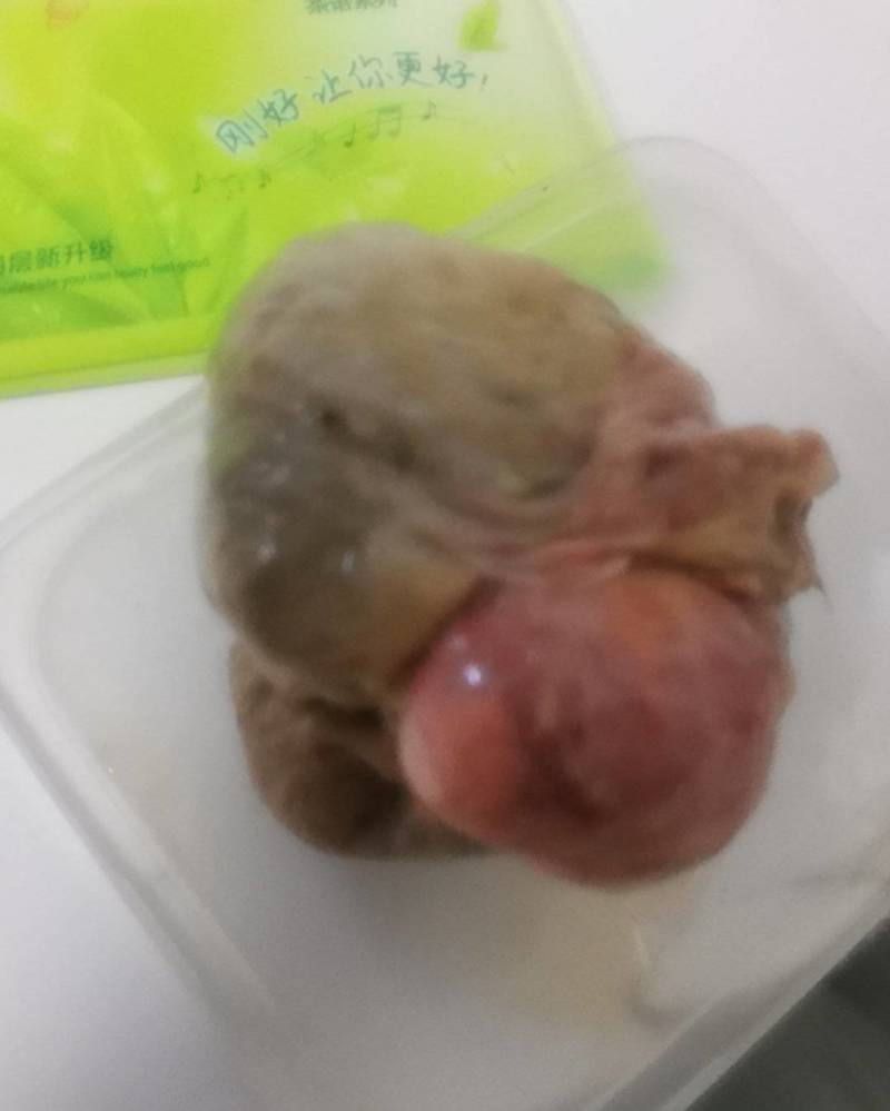湖南省衡阳市，鸡宝