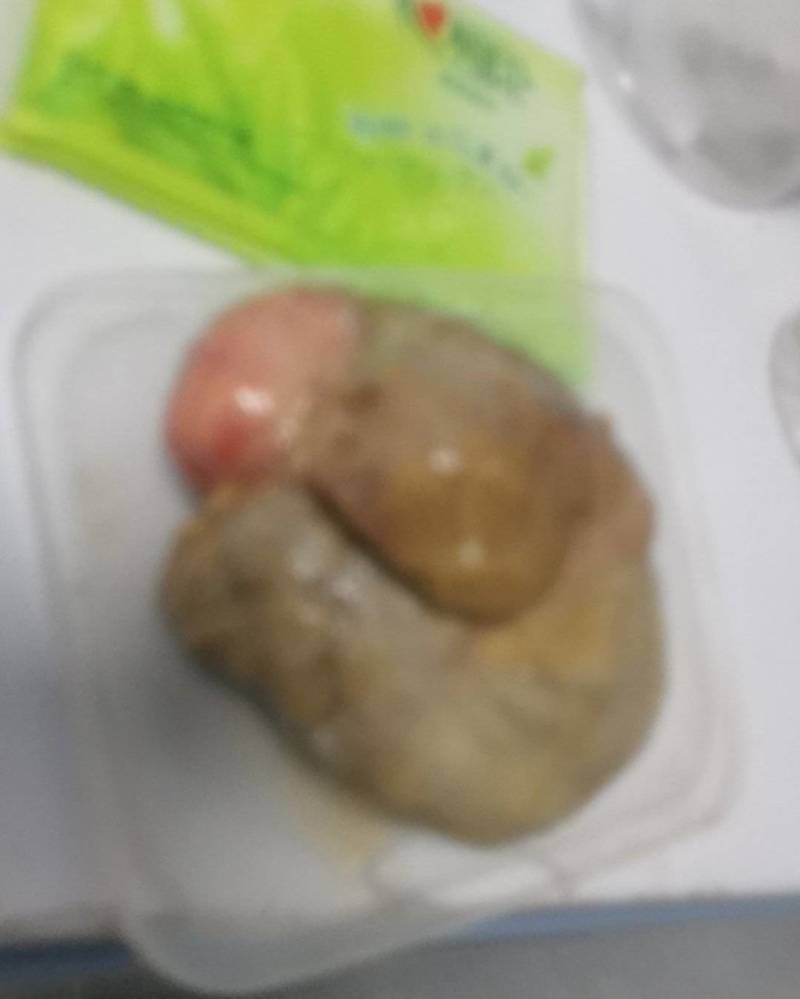 湖南省衡阳市，鸡宝