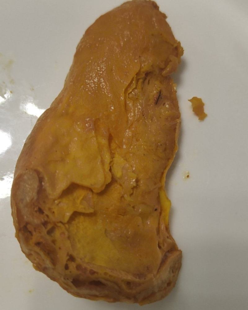**鸡宝（献鸡）