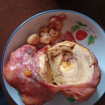 鸡宝