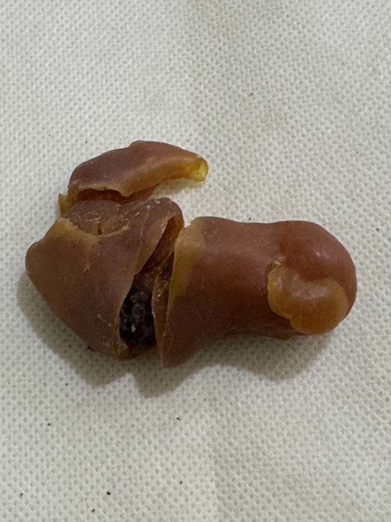 鸡宝