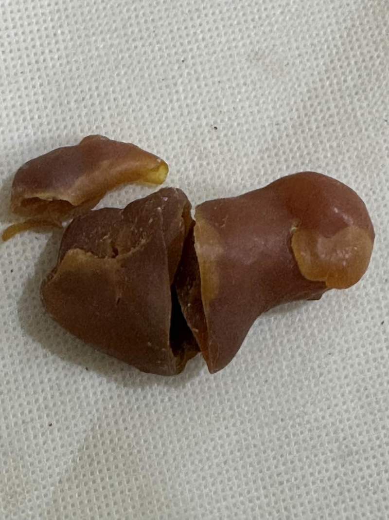 鸡宝