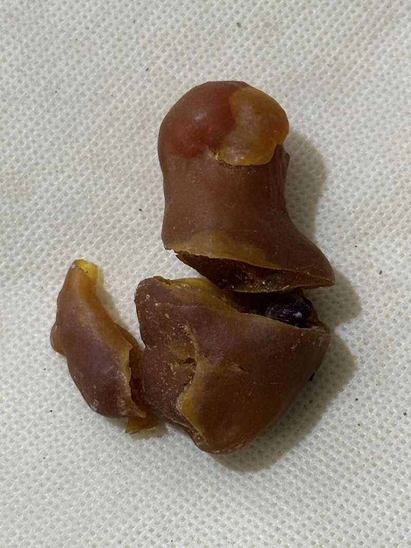 鸡宝