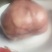 鸡宝
