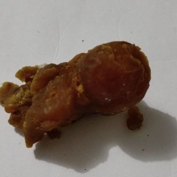 鸡宝