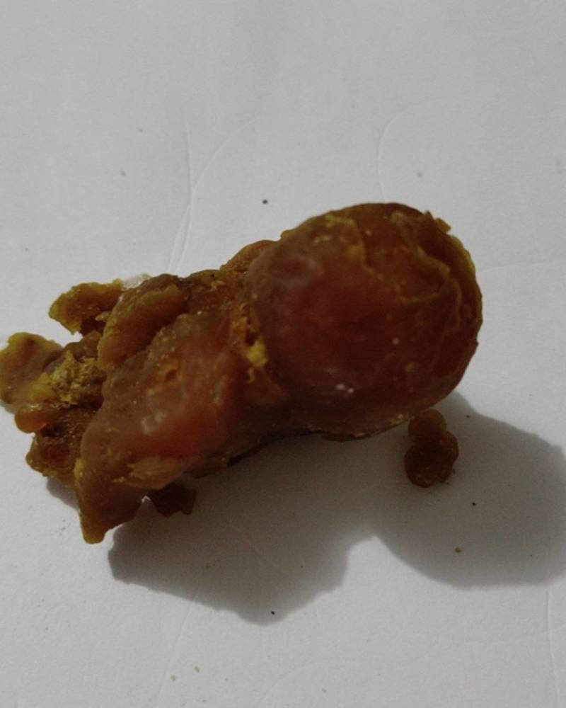鸡宝