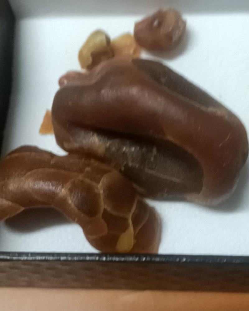 ？鸡宝