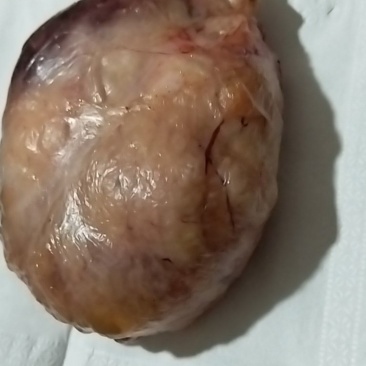 鸡宝