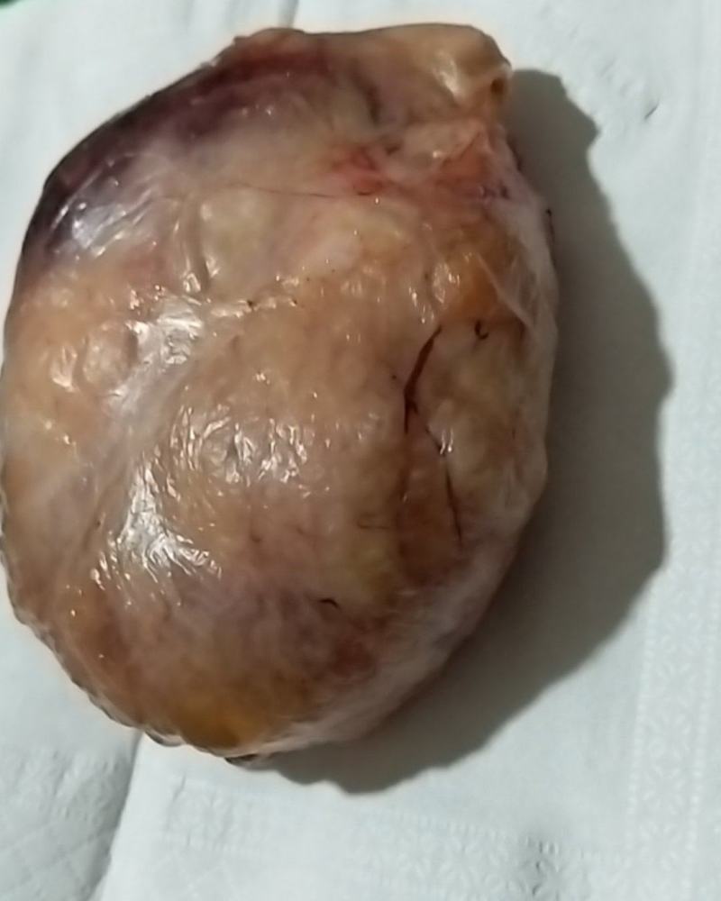 鸡宝