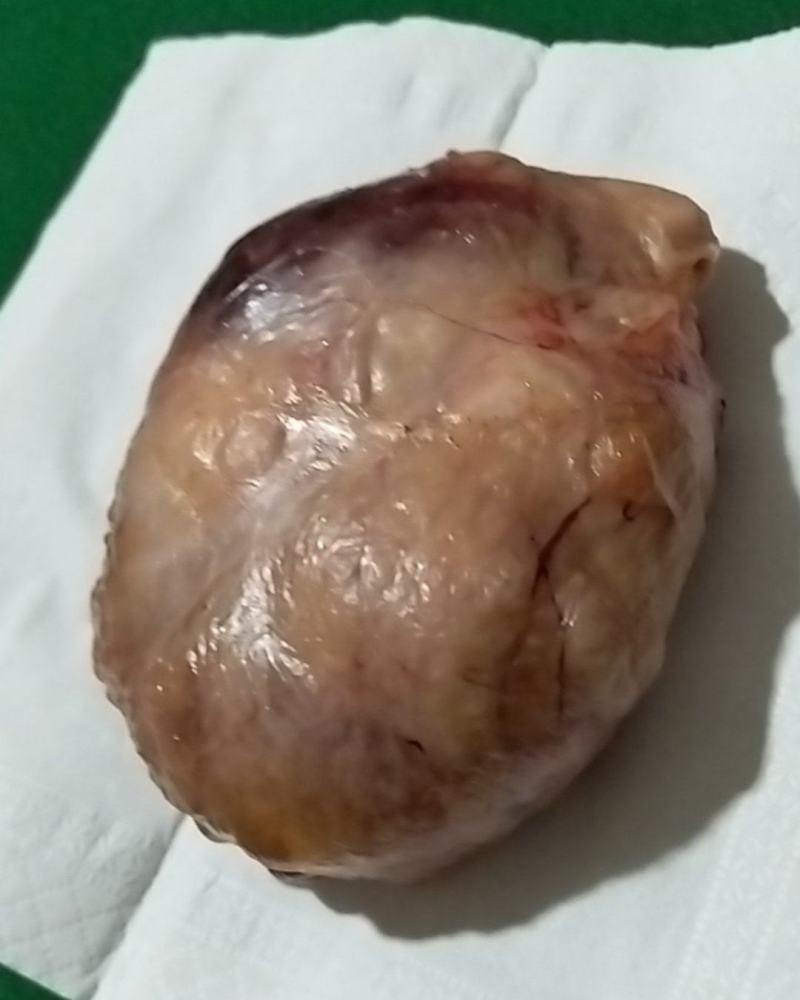 鸡宝