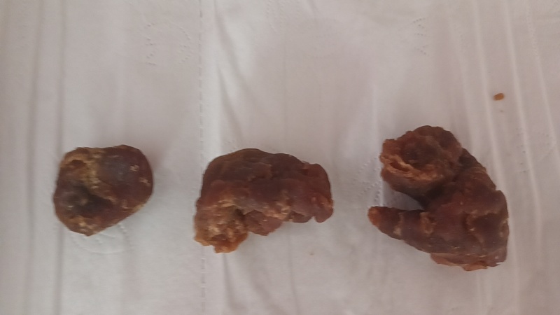 自己养了几年的鸡杀出来的鸡宝