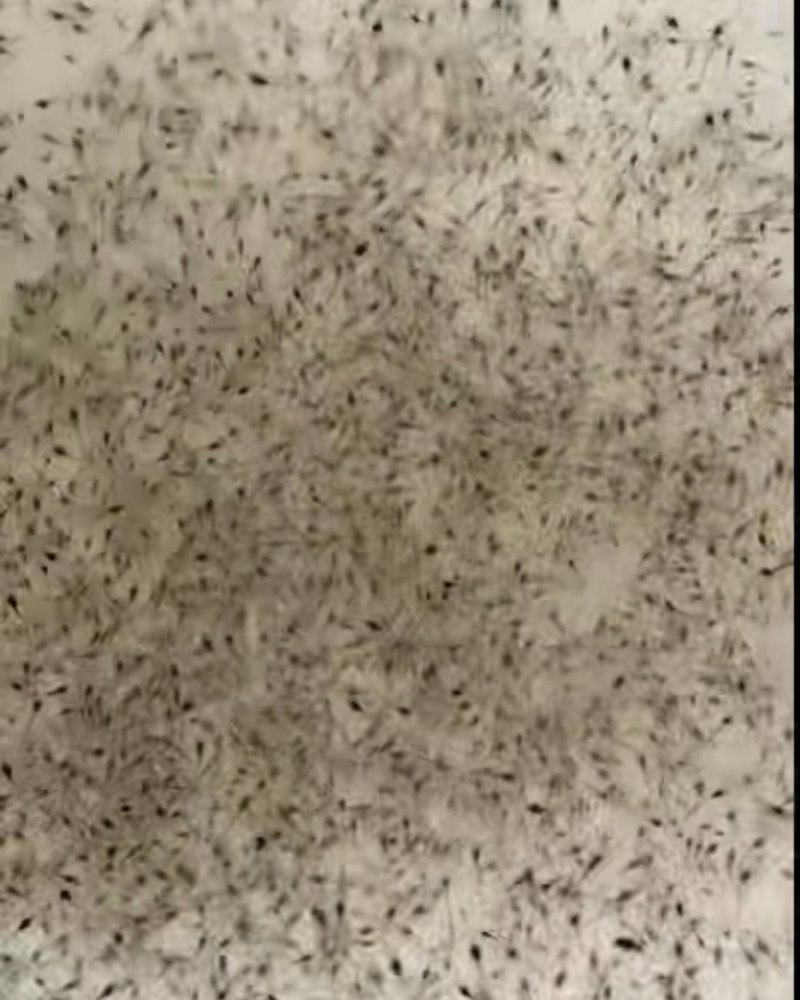 虾苗