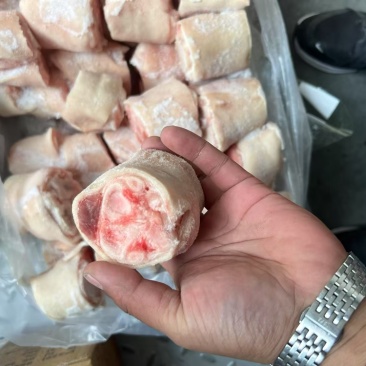 脚圈