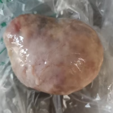 鸡宝