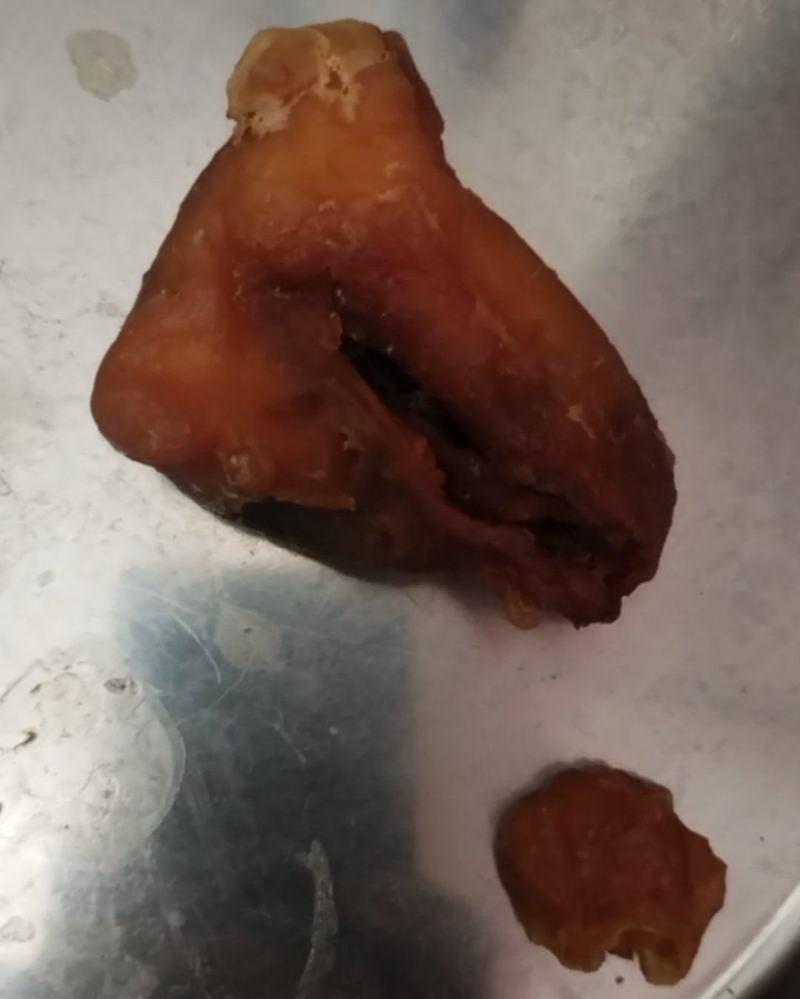 鸡宝