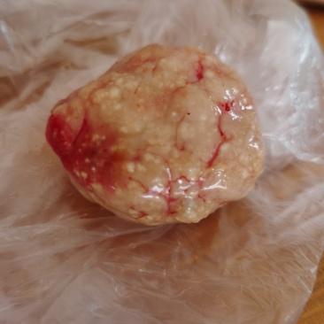 鸡宝