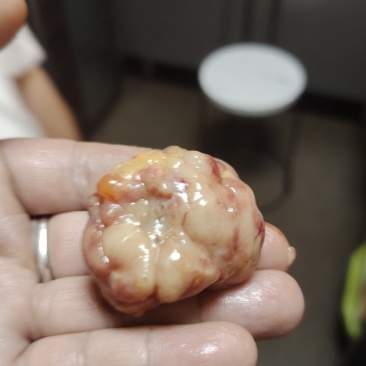 鸡宝