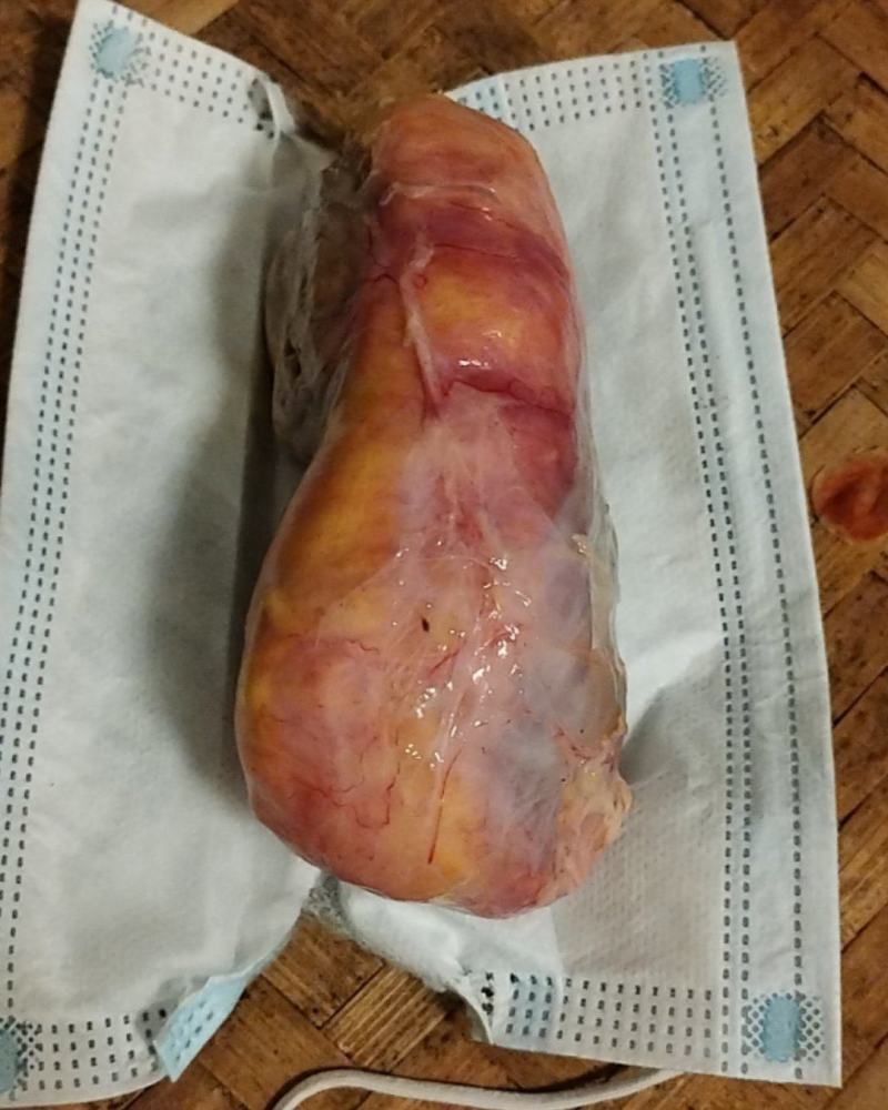 鸡宝