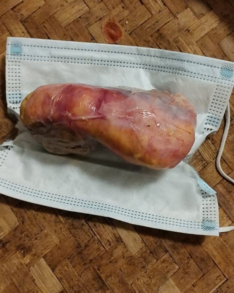 鸡宝