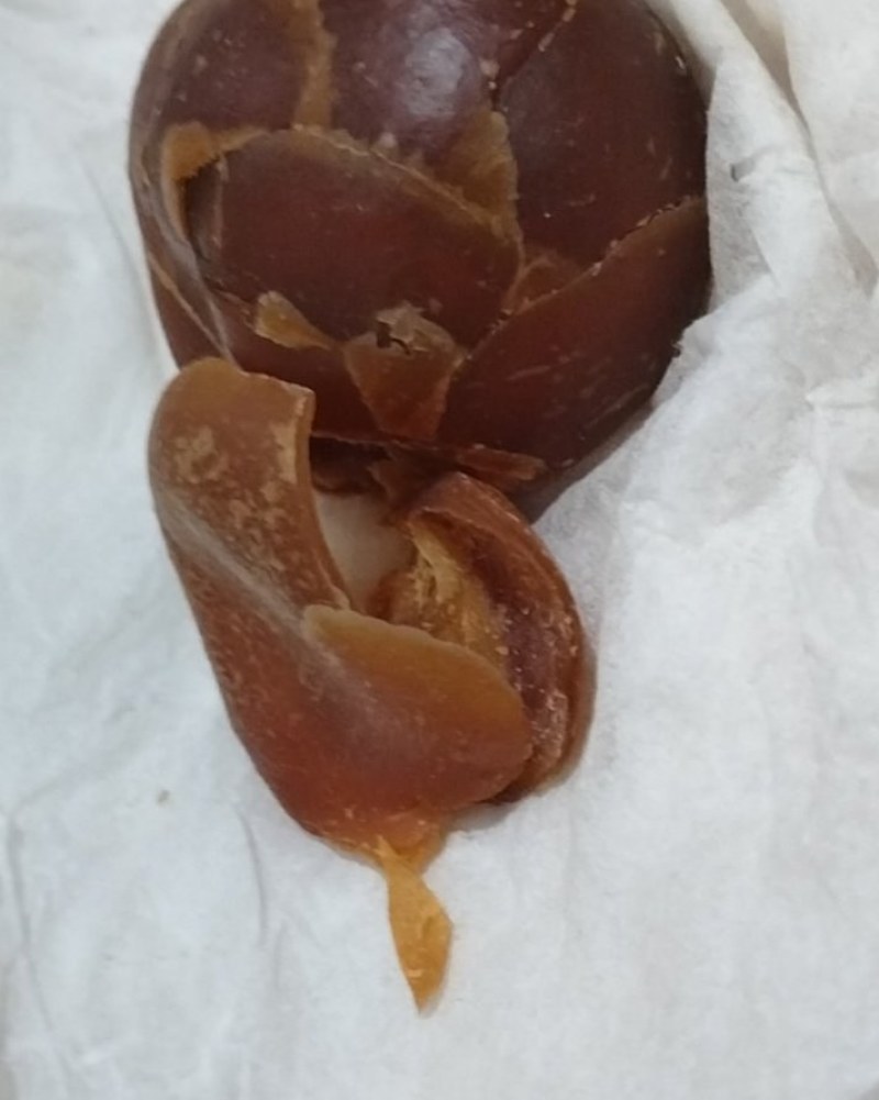 鸡宝