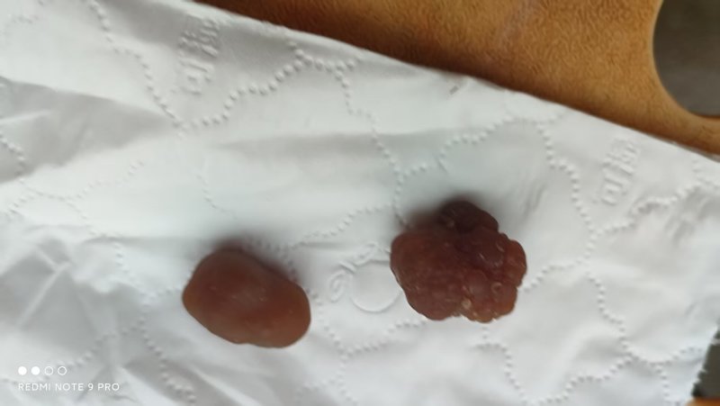 鸡宝