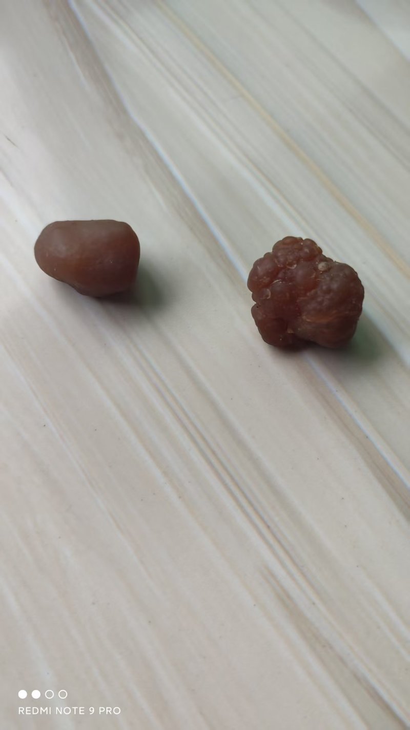 鸡宝
