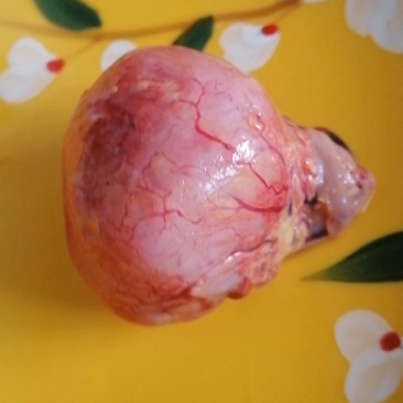 鸡宝