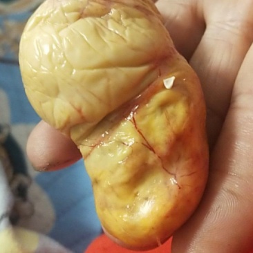 老母鸡鸡宝
