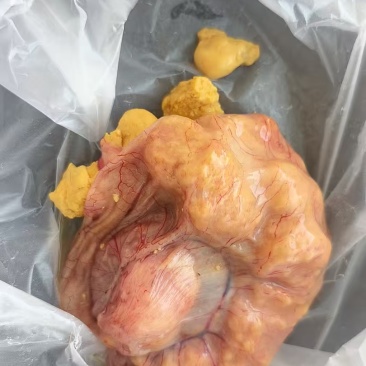 鸡宝