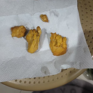 鸡宝刚刚杀鸡所得真实有郊