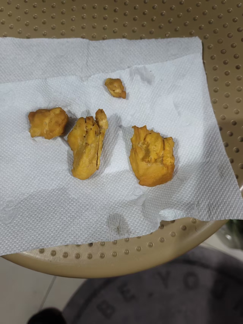 鸡宝刚刚杀鸡所得真实有郊