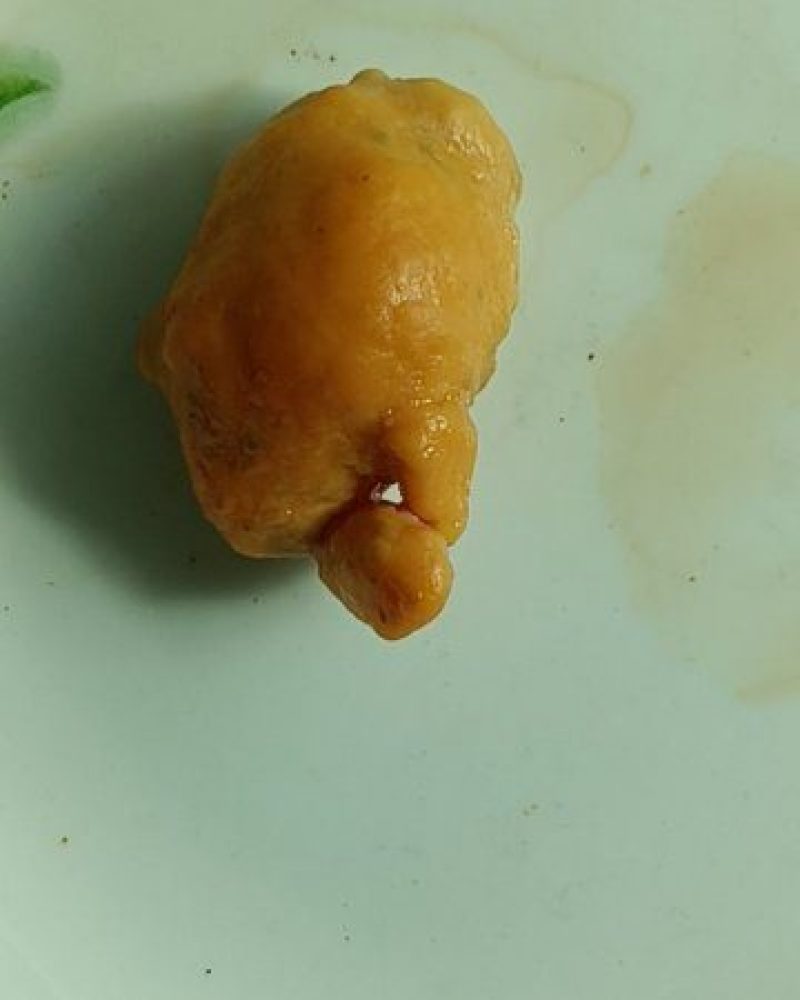 鸡宝