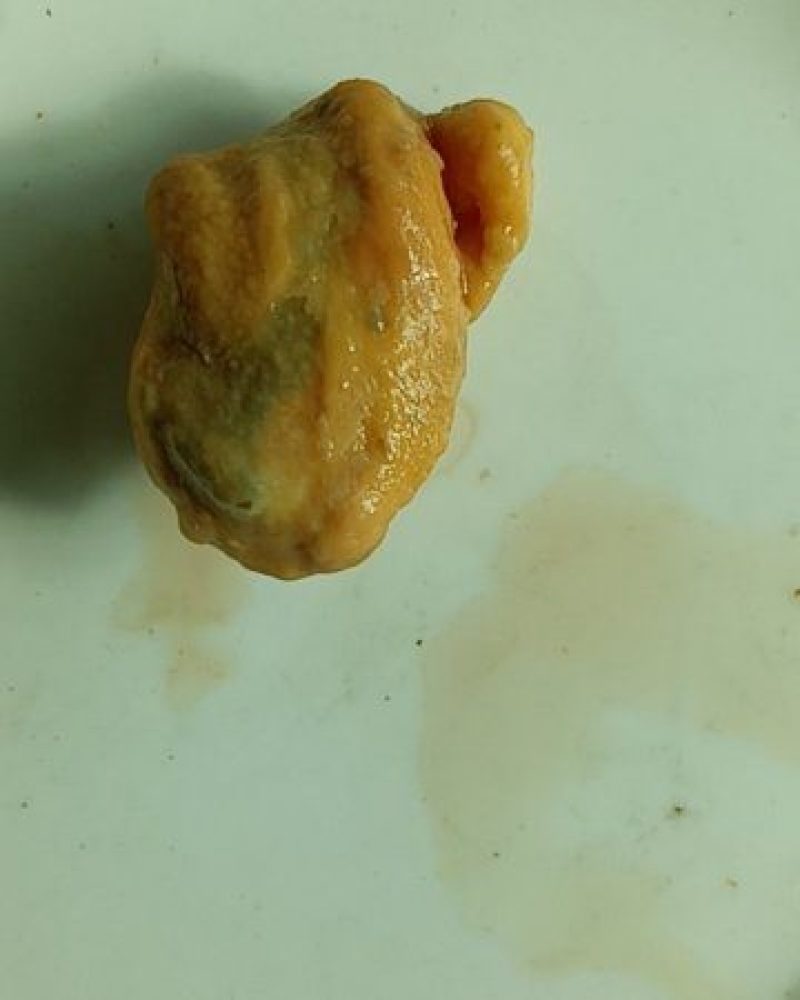 鸡宝