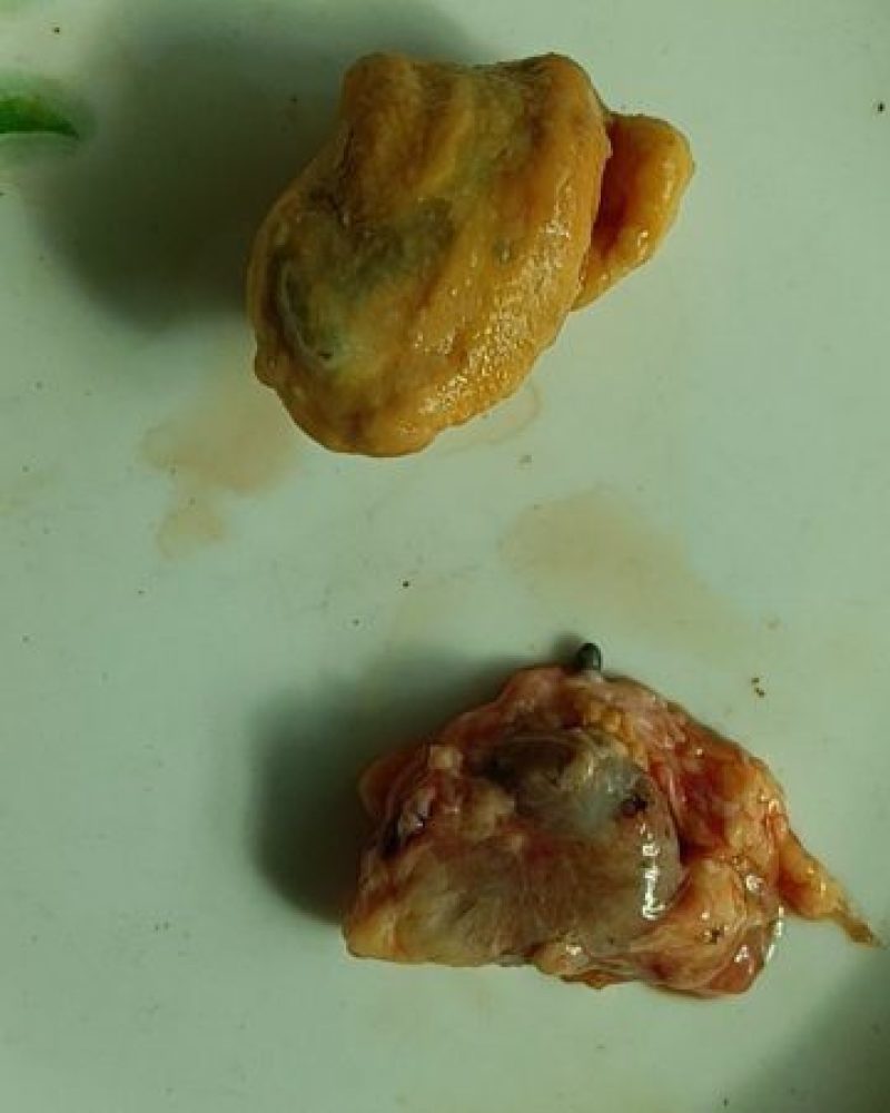 鸡宝