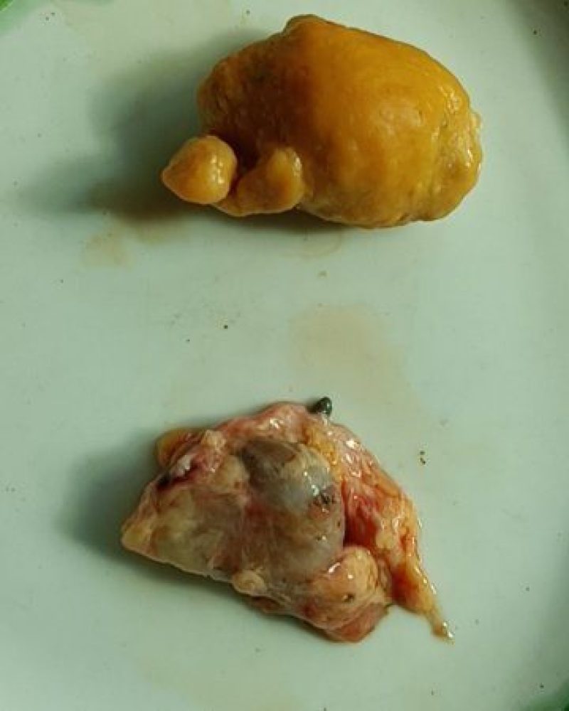 鸡宝