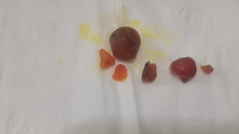 鸡宝