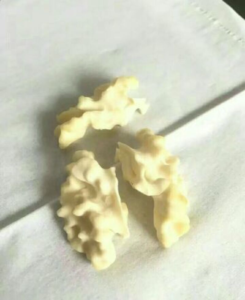 青皮核桃青皮40mm以上