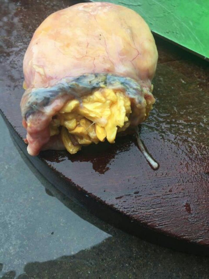 鸡宝