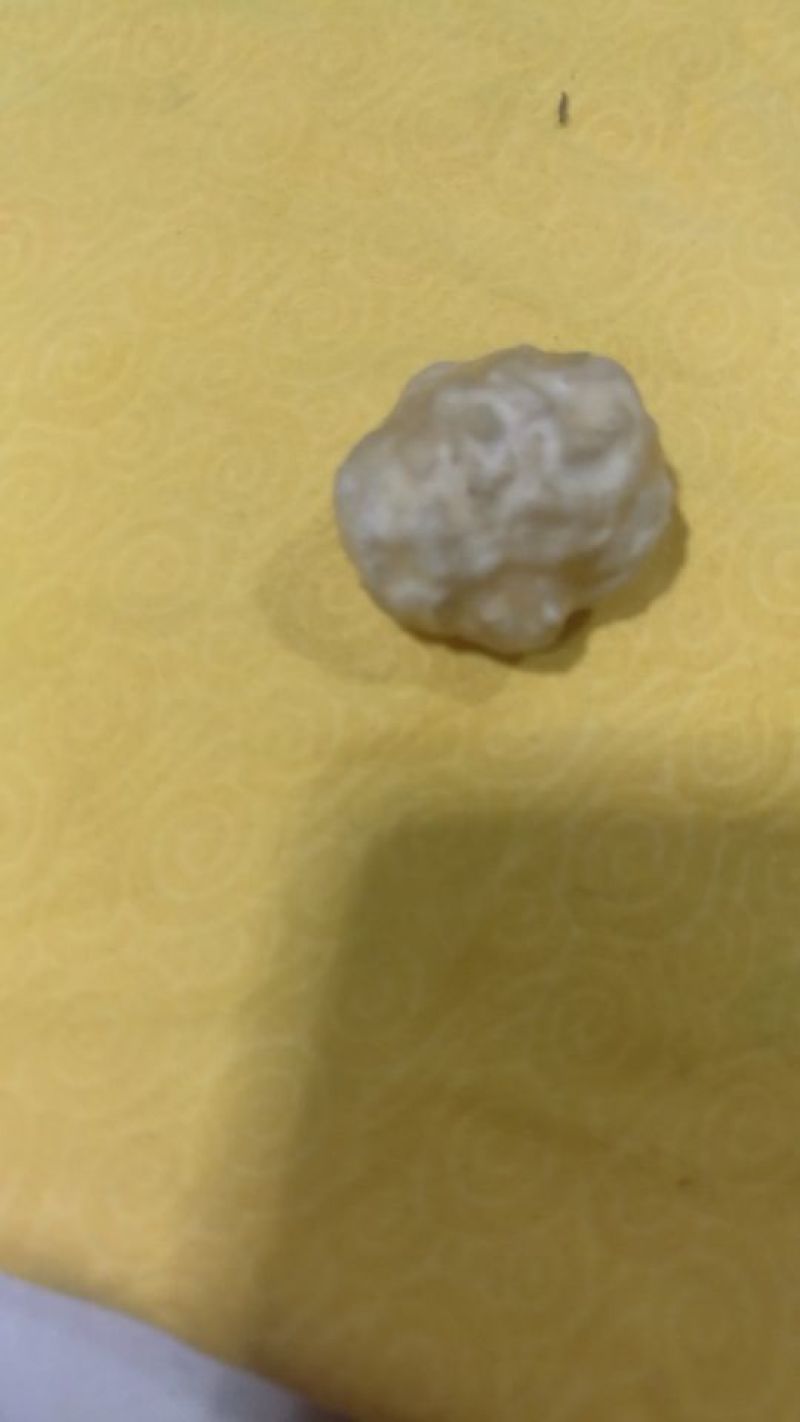 羊结石